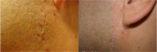 PICTURE 6